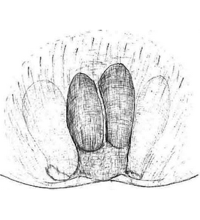 species