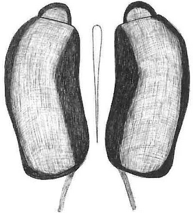 species