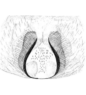 species