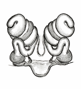 species