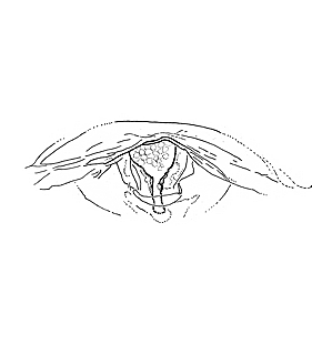 species