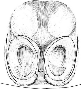 species